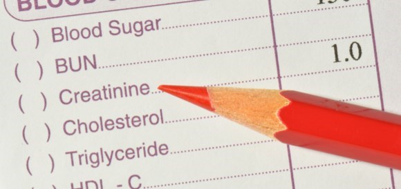 בדיקת קריאטינין (Creatinine) - תמונה